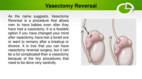 recanalization after vasectomy|vasectomy recanalization signs.